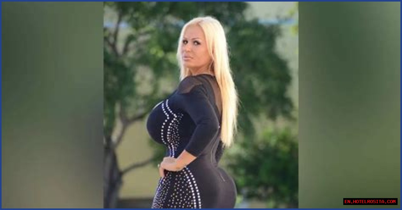 Lacey Wildd Plastic Surgery Before And After, Where Is She Now?